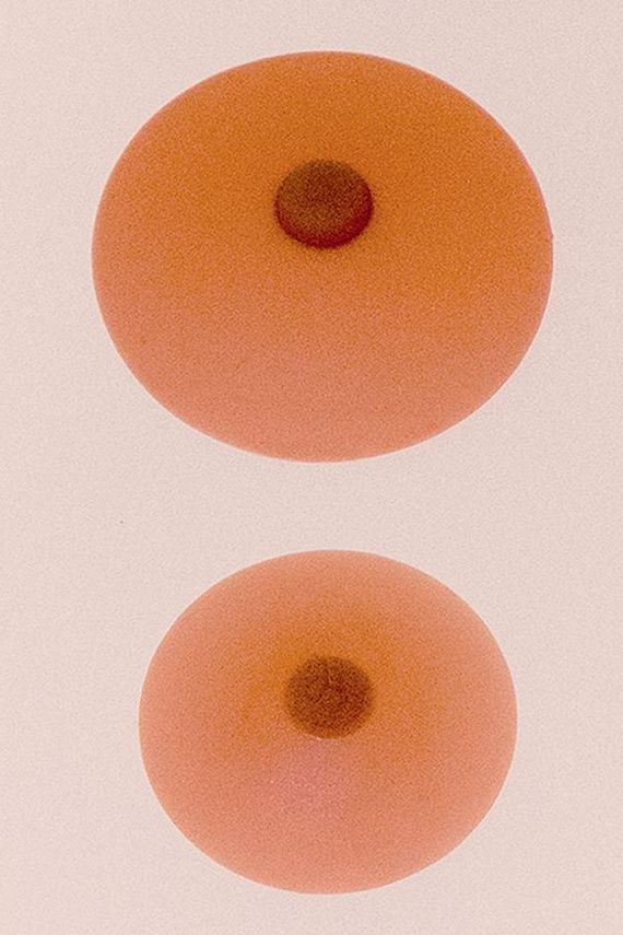 Anita Nipple (one piece) bilateral